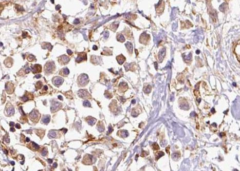 Phospho-BRCA1 (Ser1423) Antibody in Immunohistochemistry (Paraffin) (IHC (P))
