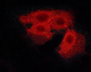 Phospho-Calcium Sensing Receptor (Thr888) Antibody in Immunocytochemistry (ICC/IF)