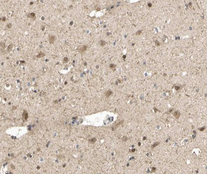 Phospho-STAT5 alpha (Ser780) Antibody in Immunohistochemistry (Paraffin) (IHC (P))