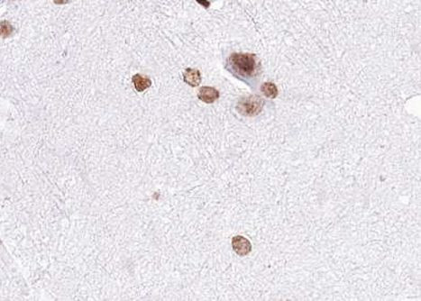 Phospho-MAP2K4 (Ser80) Antibody in Immunohistochemistry (Paraffin) (IHC (P))