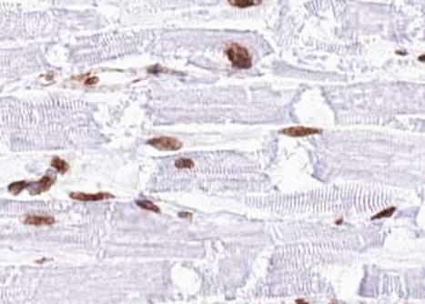 Phospho-MAP2K4 (Thr261) Antibody in Immunohistochemistry (Paraffin) (IHC (P))