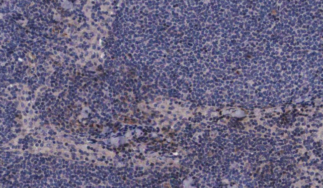 Phospho-MEK3 (Ser189) Antibody in Immunohistochemistry (Paraffin) (IHC (P))