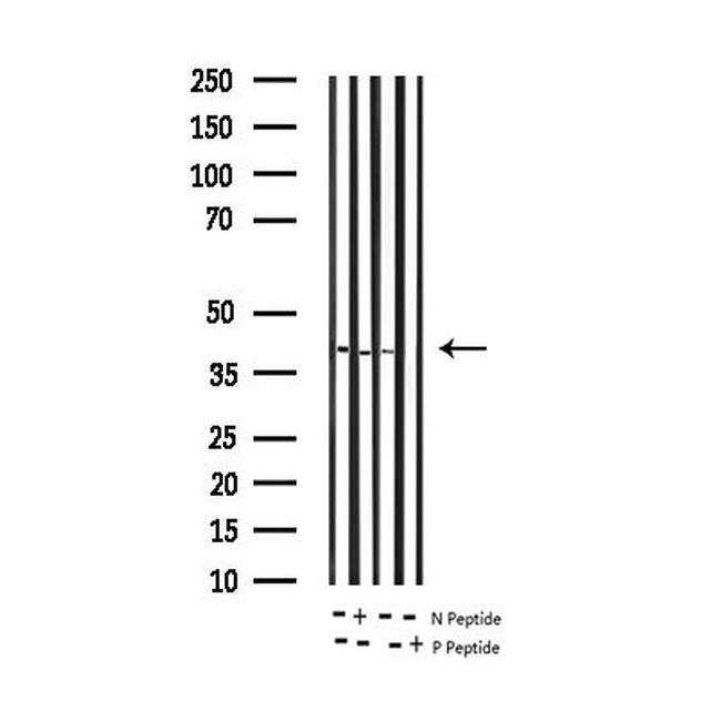 Phospho-CCR5 (Ser336) Antibody in Western Blot (WB)