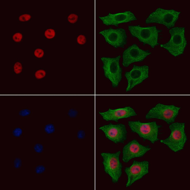 Phospho-STAT5 beta (Ser731) Antibody in Immunocytochemistry (ICC/IF)