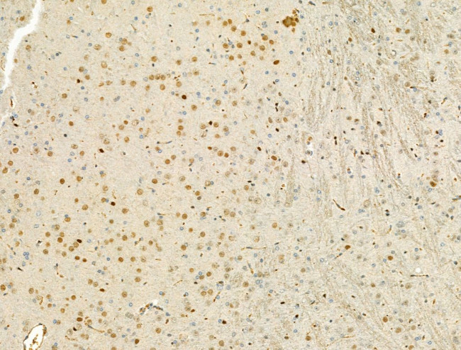 Phospho-LIMK1/LIMK2 (Thr508, Thr505) Antibody in Immunohistochemistry (Paraffin) (IHC (P))