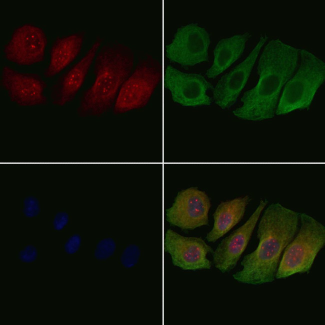 Phospho-Ataxin 1 (Ser775) Antibody in Immunocytochemistry (ICC/IF)