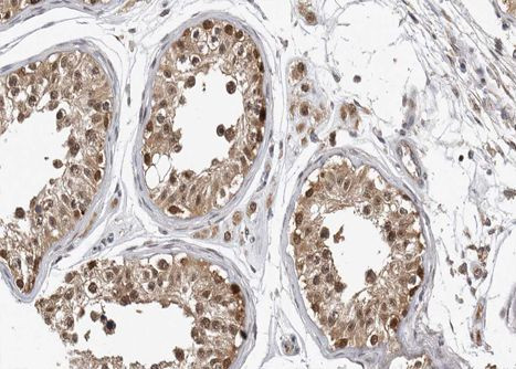Phospho-Caspase 9 (Thr125) Antibody in Immunohistochemistry (Paraffin) (IHC (P))