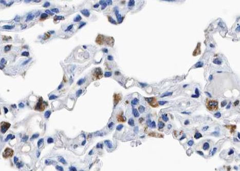 Phospho-p130Cas (Tyr410) Antibody in Immunohistochemistry (Paraffin) (IHC (P))