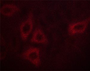 Phospho-Calmodulin 1/2/3 (Thr80, Ser82) Antibody in Immunocytochemistry (ICC/IF)