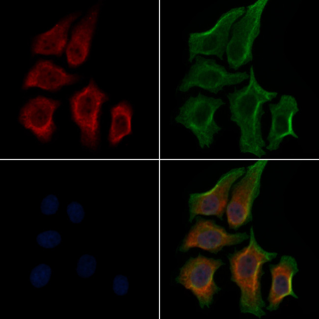 Phospho-S6 (Ser235) Antibody in Immunocytochemistry (ICC/IF)