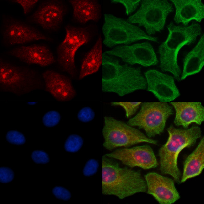 Phospho-Histone H3 (Ser11) Antibody in Immunocytochemistry (ICC/IF)