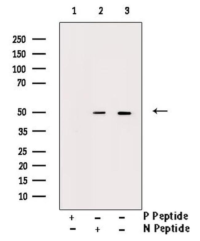 Phospho-Smad3 (Ser204) Antibody in Western Blot (WB)