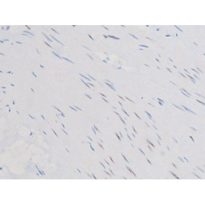 Phospho-Smad3 (Ser213) Antibody in Immunohistochemistry (Paraffin) (IHC (P))