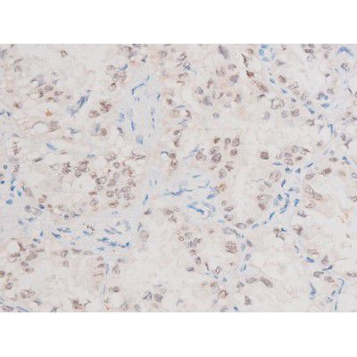 Phospho-XIAP (Ser87) Antibody in Immunohistochemistry (Paraffin) (IHC (P))