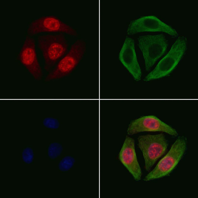 Phospho-FOXO4 (Thr451) Antibody in Immunocytochemistry (ICC/IF)