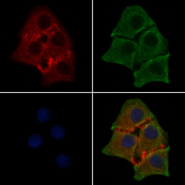 Phospho-CDK5 (Tyr15) Antibody in Immunocytochemistry (ICC/IF)
