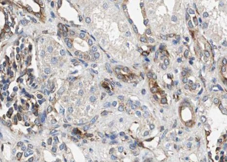 Phospho-RelB (Ser573) Antibody in Immunohistochemistry (Paraffin) (IHC (P))