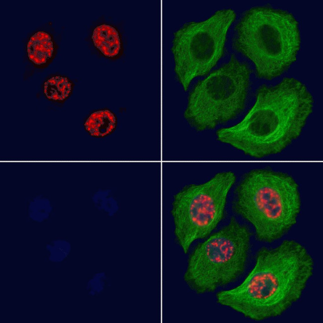 Phospho-MEF2A (Thr312) Antibody in Immunocytochemistry (ICC/IF)