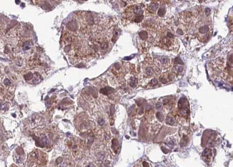 Phospho-MAP2K1/MAP2K2 (Ser218) Antibody in Immunohistochemistry (Paraffin) (IHC (P))