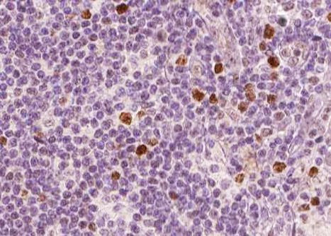 Phospho-NFkB p65 (Ser311) Antibody in Immunohistochemistry (Paraffin) (IHC (P))