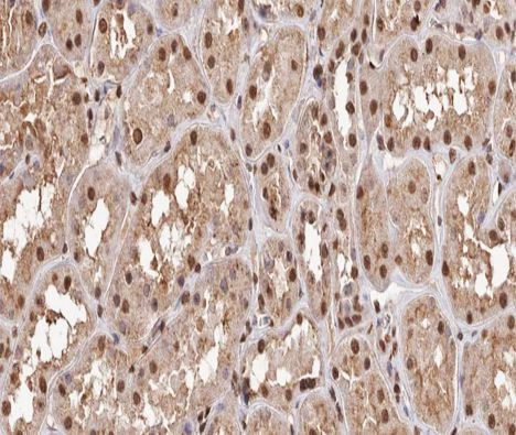Phospho-NFkB p65 (Thr254) Antibody in Immunohistochemistry (Paraffin) (IHC (P))