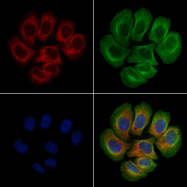 Phospho-FAK (Tyr576) Antibody in Immunocytochemistry (ICC/IF)