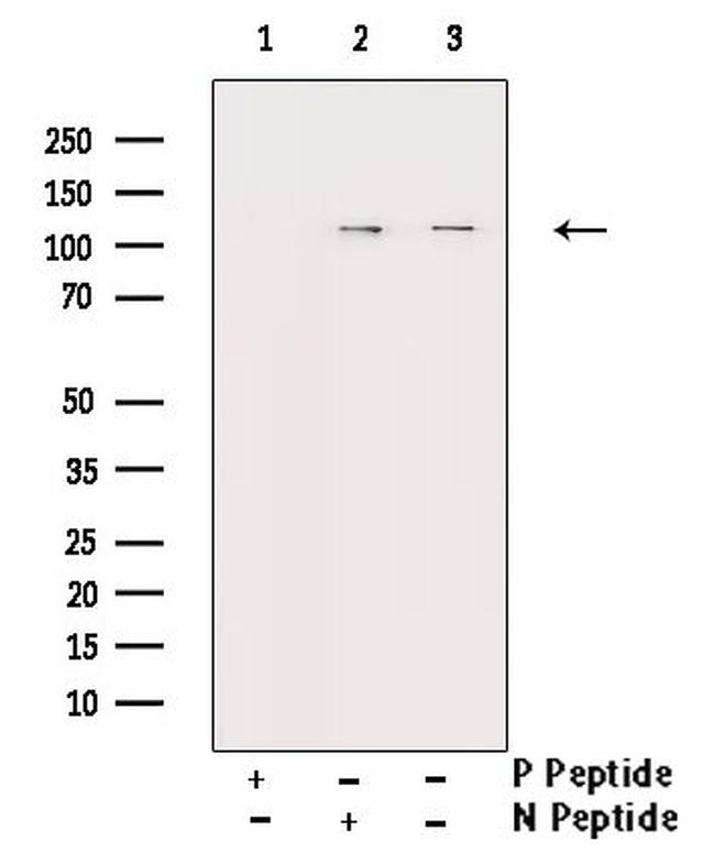 Phospho-FAK (Ser843) Antibody in Western Blot (WB)