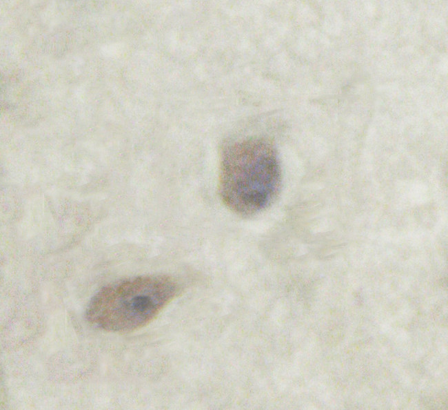 Phospho-PKC zeta (Thr560) Antibody in Immunohistochemistry (Paraffin) (IHC (P))