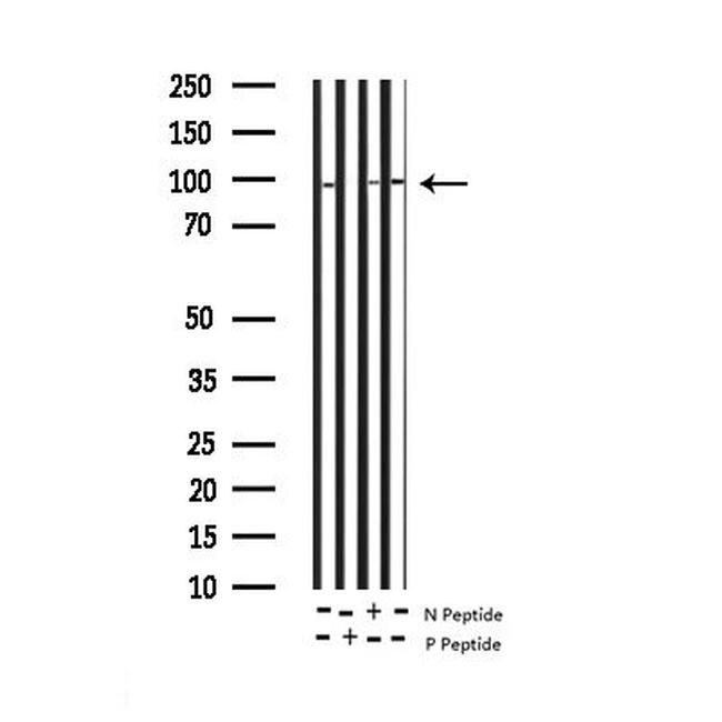 Phospho-PKC delta (Tyr64) Antibody in Western Blot (WB)