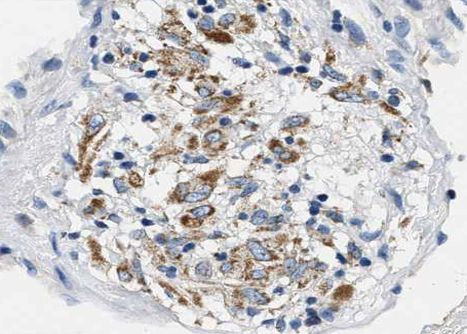 Phospho-BCL-XL (Ser62) Antibody in Immunohistochemistry (Paraffin) (IHC (P))