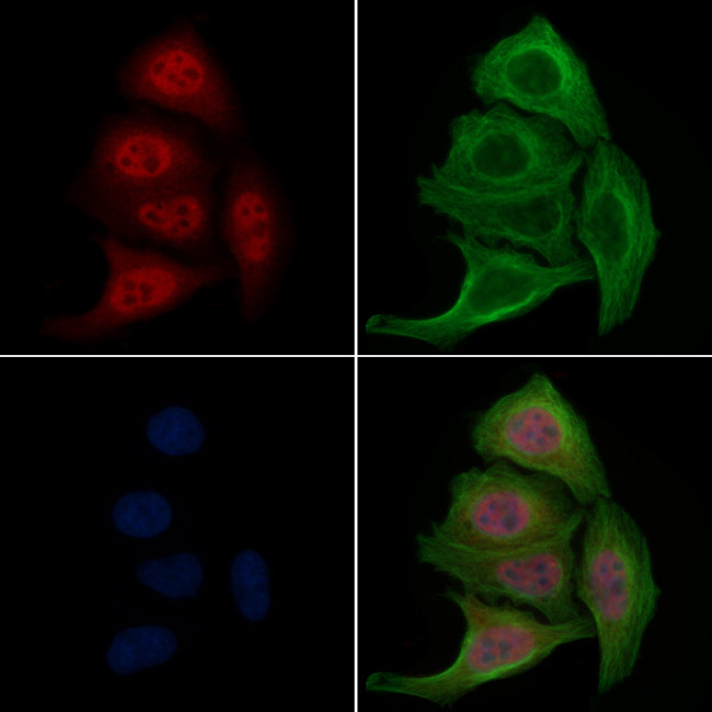 Phospho-FOXO1 (Ser329) Antibody in Immunocytochemistry (ICC/IF)