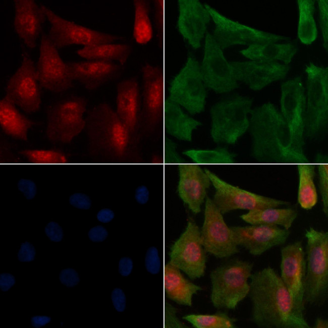 Phospho-FOXO1/FOXO3/FOXO4 (Thr24, Thr32) Antibody in Immunocytochemistry (ICC/IF)
