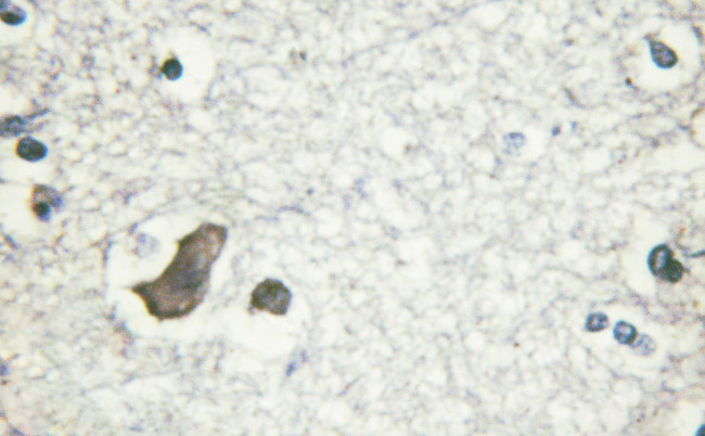 Phospho-NMDAR2B (Tyr1474) Antibody in Immunohistochemistry (Paraffin) (IHC (P))