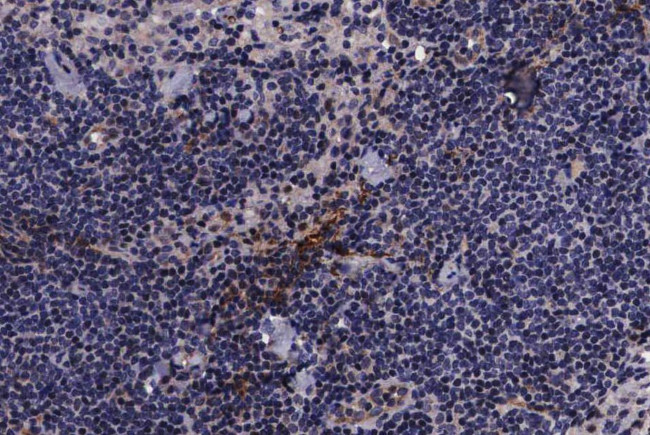 Phospho-PIN1 (Ser16) Antibody in Immunohistochemistry (Paraffin) (IHC (P))