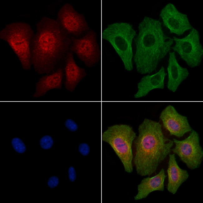 Phospho-4EBP1 (Thr36) Antibody in Immunocytochemistry (ICC/IF)