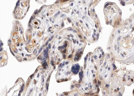 Phospho-PKD1/2/3/PKC mu (Ser738, Ser742) Antibody in Immunohistochemistry (Paraffin) (IHC (P))