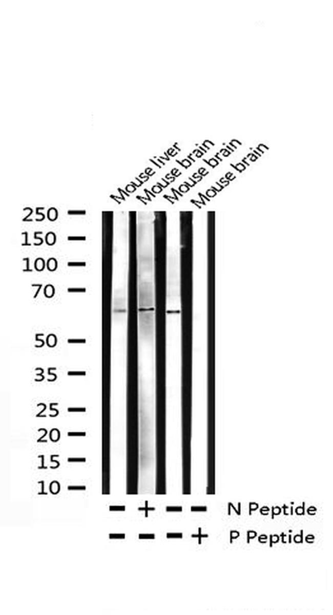 Phospho-LKB1 (Thr189) Antibody in Western Blot (WB)