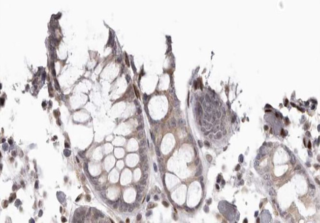Phospho-Cdc37 (Ser13) Antibody in Immunohistochemistry (Paraffin) (IHC (P))