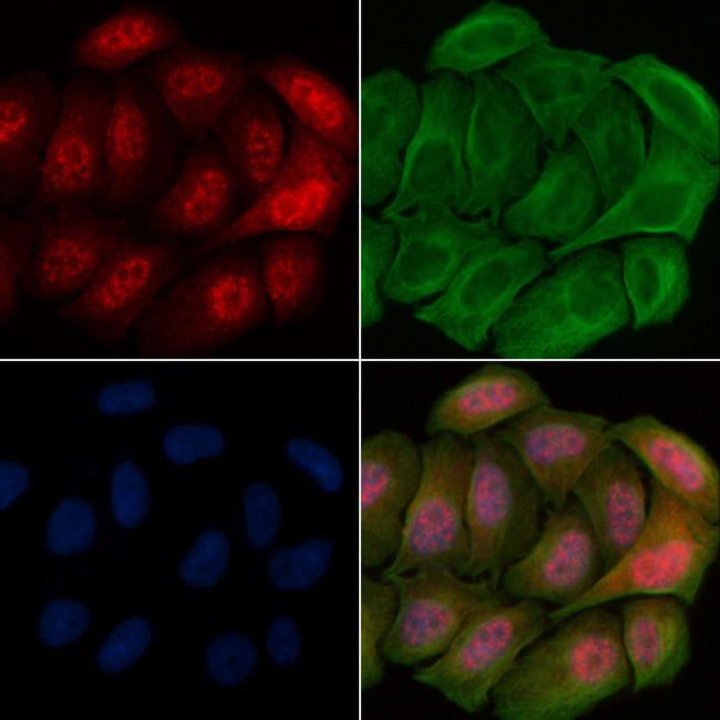 Phospho-CAMKIV (Thr200) Antibody in Immunocytochemistry (ICC/IF)