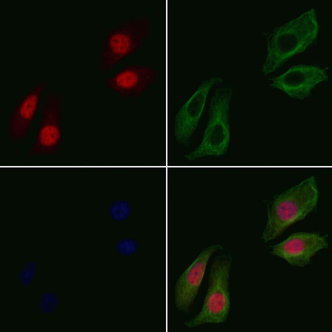 Phospho-PDCD4 (Ser67) Antibody in Immunocytochemistry (ICC/IF)