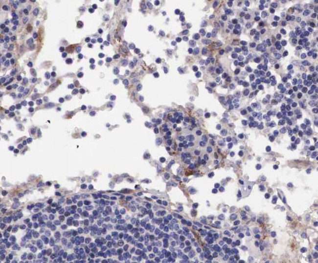 Phospho-BLNK (Tyr96) Antibody in Immunohistochemistry (Paraffin) (IHC (P))