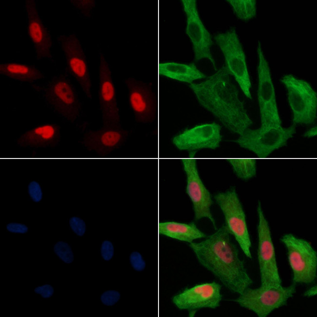 Phospho-HDAC2 (Ser394) Antibody in Immunocytochemistry (ICC/IF)
