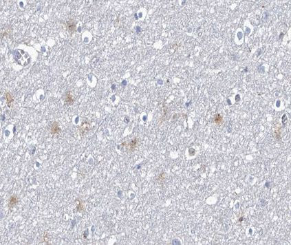 Phospho-CPI-17 (Thr38) Antibody in Immunohistochemistry (Paraffin) (IHC (P))