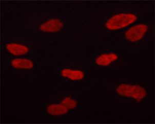 Phospho-Aurora B (Thr232) Antibody in Immunocytochemistry (ICC/IF)