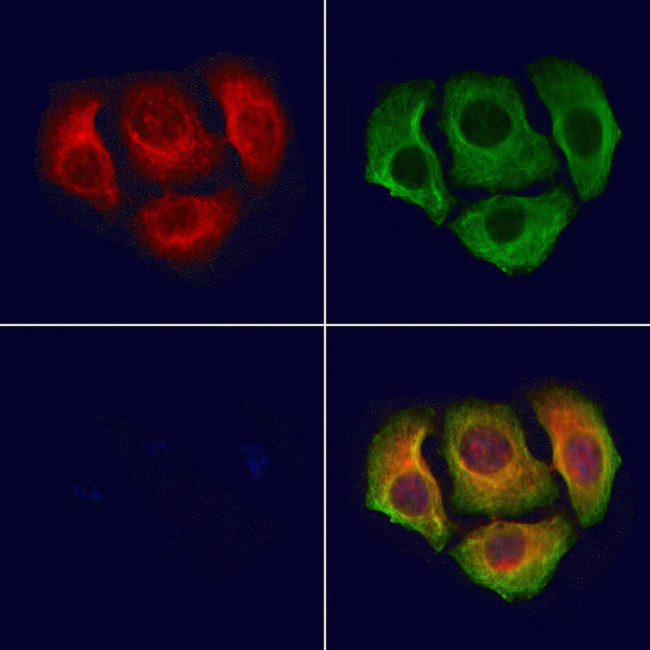 Phospho-DOK1 (Tyr398) Antibody in Immunocytochemistry (ICC/IF)