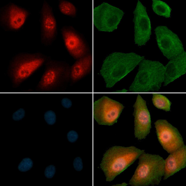 Phospho-HDAC8 (Ser39) Antibody in Immunocytochemistry (ICC/IF)