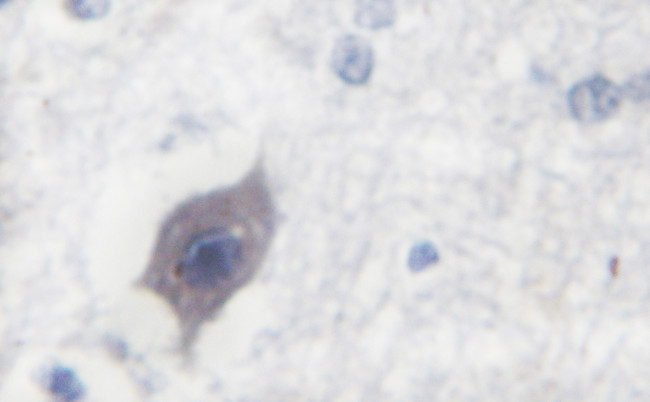 Phospho-ALK (Tyr1507) Antibody in Immunohistochemistry (Paraffin) (IHC (P))