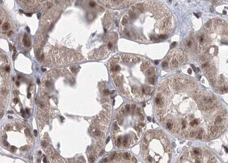 Phospho-CaMKII alpha/beta/delta (Thr305) Antibody in Immunohistochemistry (Paraffin) (IHC (P))