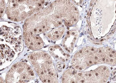 Phospho-AMPK beta-1 (Ser181) Antibody in Immunohistochemistry (Paraffin) (IHC (P))