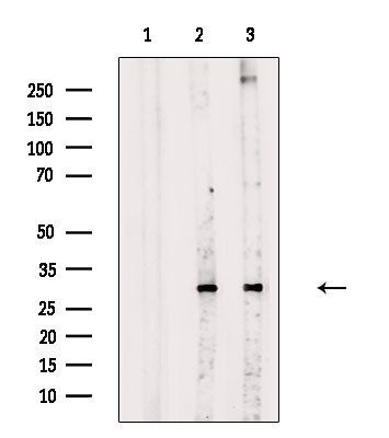 Phospho-DKK1 (Ser140) Antibody in Western Blot (WB)
